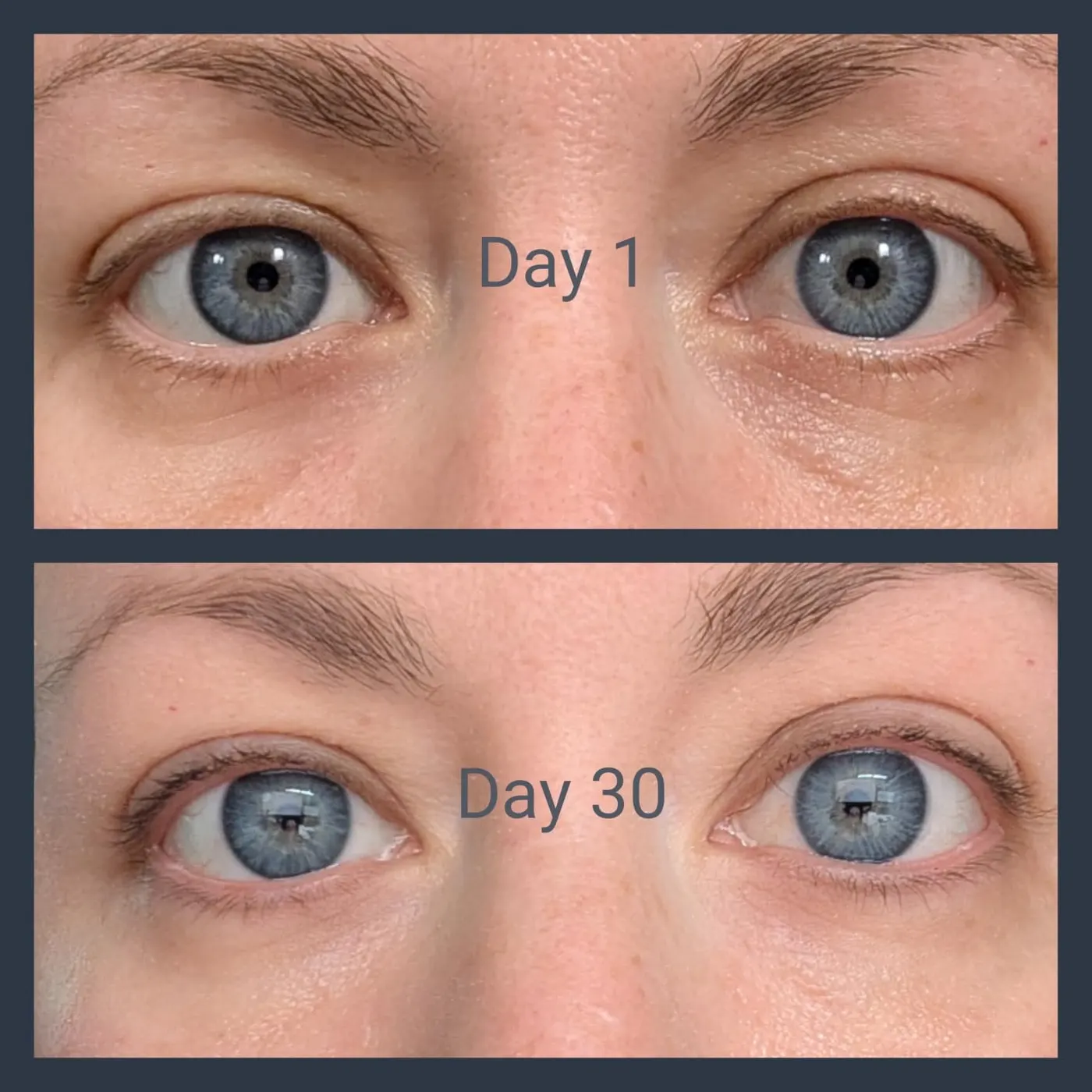Comparación de la mirada en el día 1 y en el día 30 de uso de ELYUNEA Volume Balm